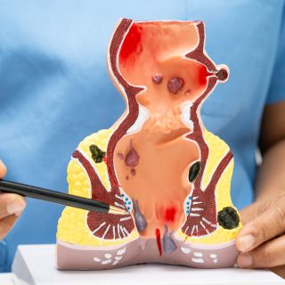 Sollievo immediato dal dolore e dal bruciore